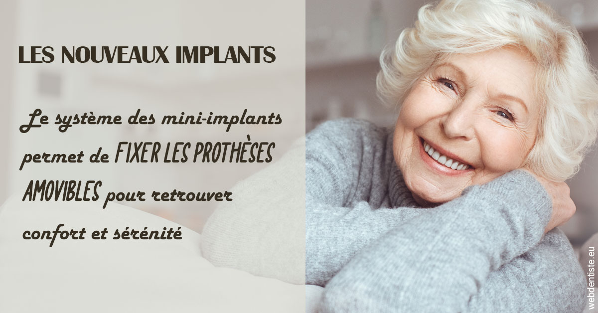 https://dr-strauss-jp.chirurgiens-dentistes.fr/Les nouveaux implants 1