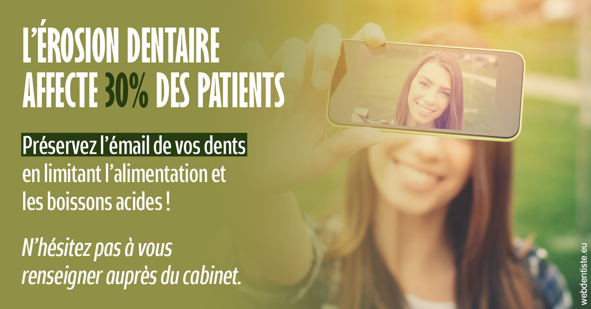 https://dr-strauss-jp.chirurgiens-dentistes.fr/L'érosion dentaire 1