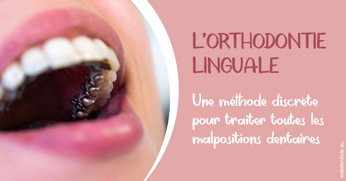 https://dr-strauss-jp.chirurgiens-dentistes.fr/L'orthodontie linguale 2