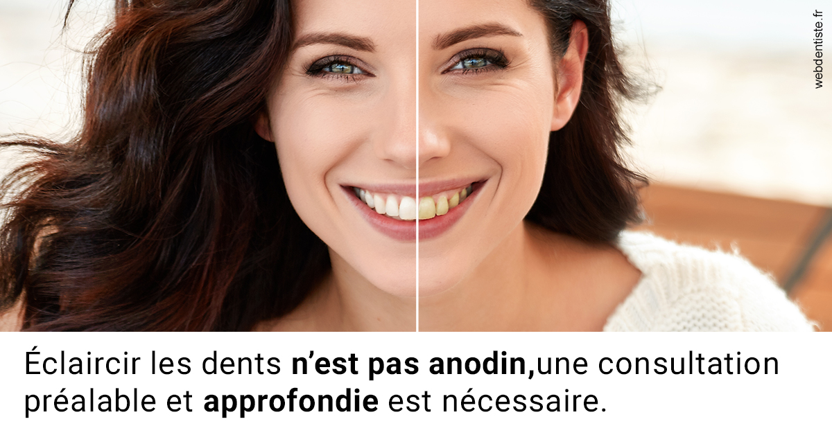 https://dr-strauss-jp.chirurgiens-dentistes.fr/Le blanchiment 2