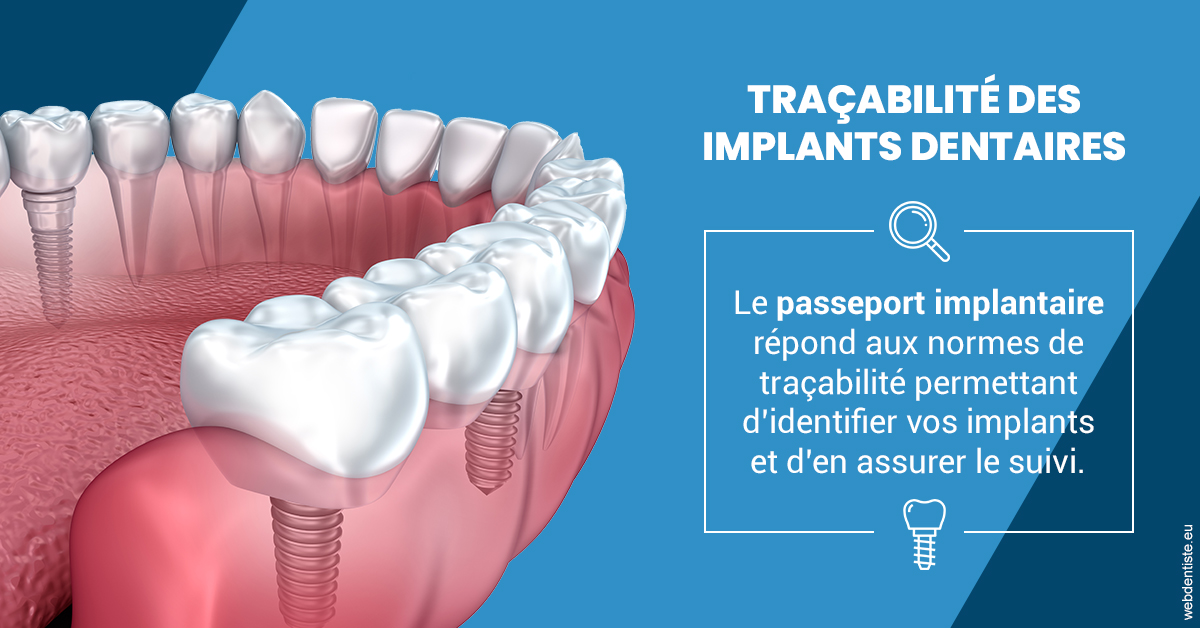 https://dr-strauss-jp.chirurgiens-dentistes.fr/T2 2023 - Traçabilité des implants 1