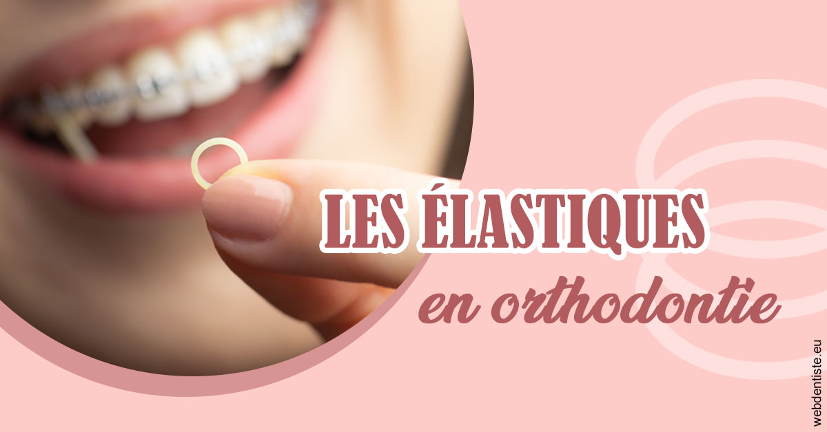 https://dr-strauss-jp.chirurgiens-dentistes.fr/Elastiques orthodontie 1