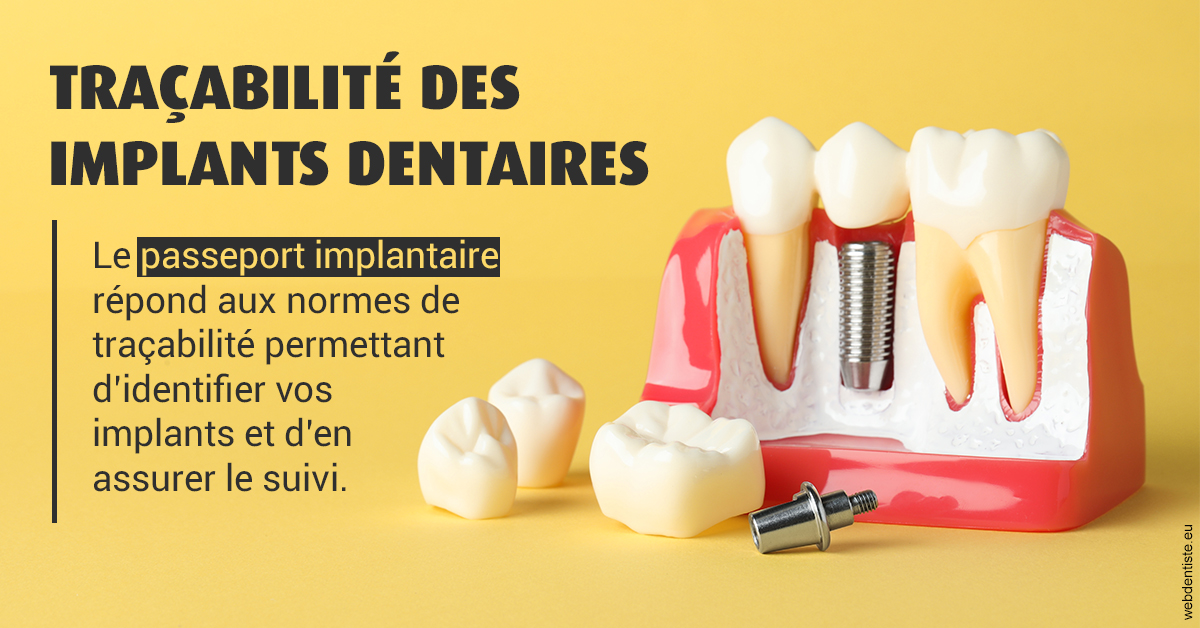 https://dr-strauss-jp.chirurgiens-dentistes.fr/T2 2023 - Traçabilité des implants 2