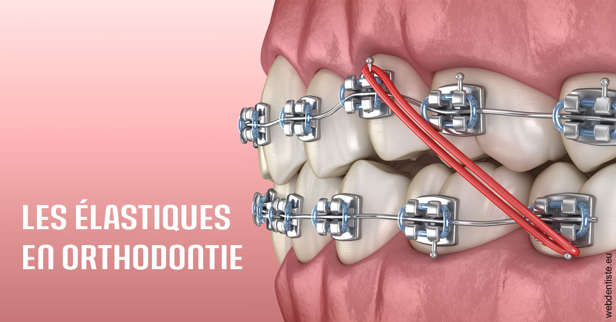 https://dr-strauss-jp.chirurgiens-dentistes.fr/Elastiques orthodontie 2