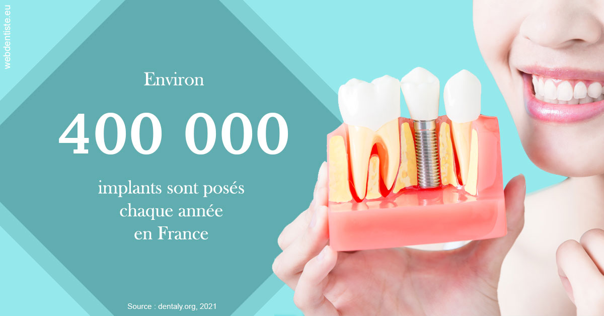 https://dr-strauss-jp.chirurgiens-dentistes.fr/Pose d'implants en France 2